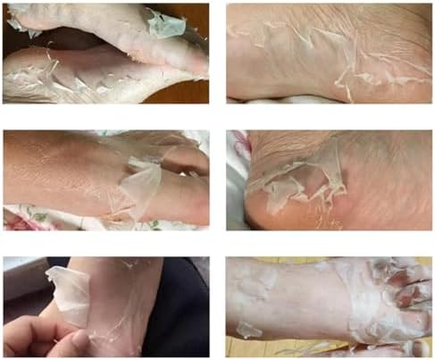 Alternative view of Ayak Peeling Maskesi Nasır, Ölü Deri Temizleyici, Nemlendirici Özellik, Lavanta Yağı ve C Vitamini İçerir