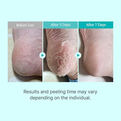 Alternative view of Ariul Smooth & Pure Exfoliating Foot Peeling Mask 2 pairs - Yenileyici & Arındırıcı Ayak Peeling Maskesi 2 çift