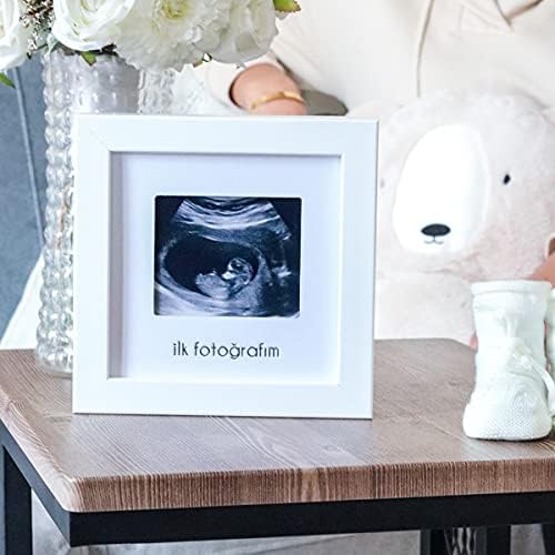 İlk Fotoğrafım Bebek Ultrason Çerçevesi - Bebek Odası Resim Anı Çerçevesi