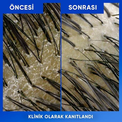 Alternative view of & Shoulders Arındırma ve Parlaklık Kepeğe Karşı Etkili Şampuan 330ml