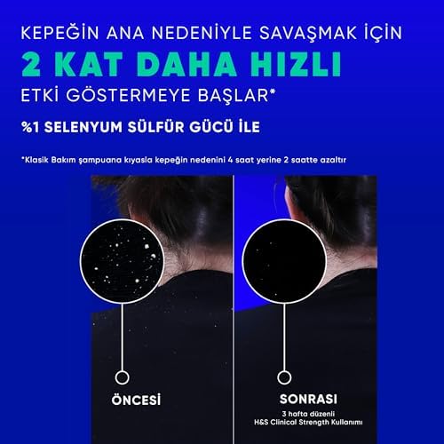 Alternative view of &Shoulders Clinical Strength Cooling Itch Rescue Kaşıntı Karşıtı Şampuan 400 ml