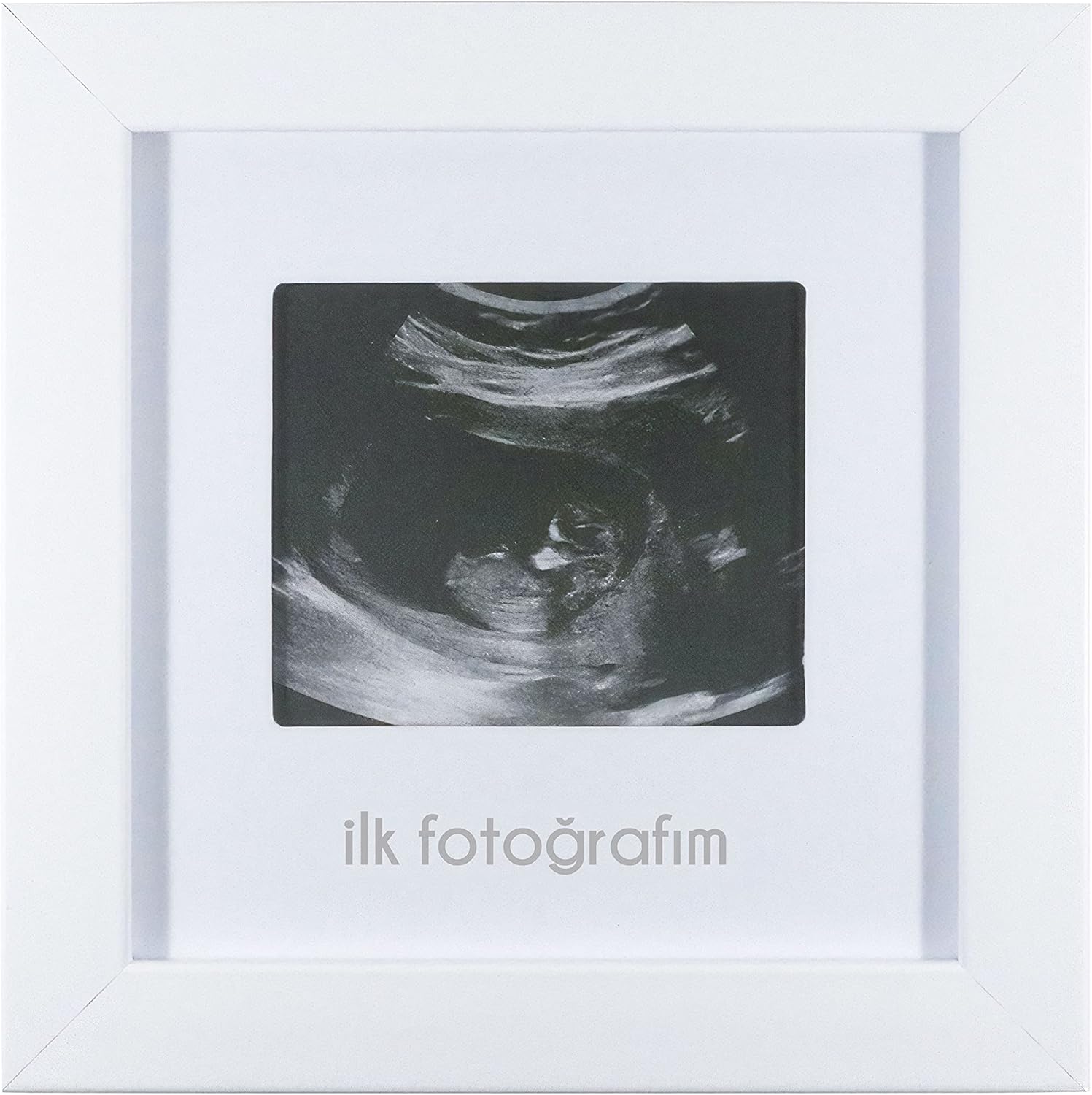İlk Fotoğrafım Bebek Ultrason Çerçevesi - Bebek Odası Resim Anı Çerçevesi - Görsel 3