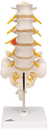 3B Scientific A76/5 Bel Omurga Sütunu, Dorso-Lateral Prolapsed Intervertebral Disk, 34 cm Yükseklik - Görsel 3