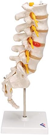 3B Scientific A76/5 Bel Omurga Sütunu, Dorso-Lateral Prolapsed Intervertebral Disk, 34 cm Yükseklik