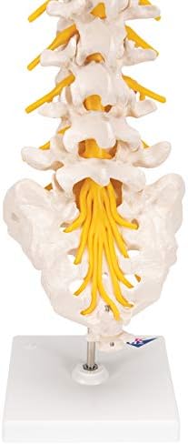 Alternative view of 3B Scientific A76/5 Bel Omurga Sütunu, Dorso-Lateral Prolapsed Intervertebral Disk, 34 cm Yükseklik